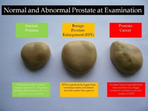 Perbezaan prostat bengkak berbanding normal 