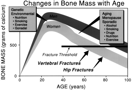 Graf menunjukkan kekurangan jisim tulang menurun selari dengan usia