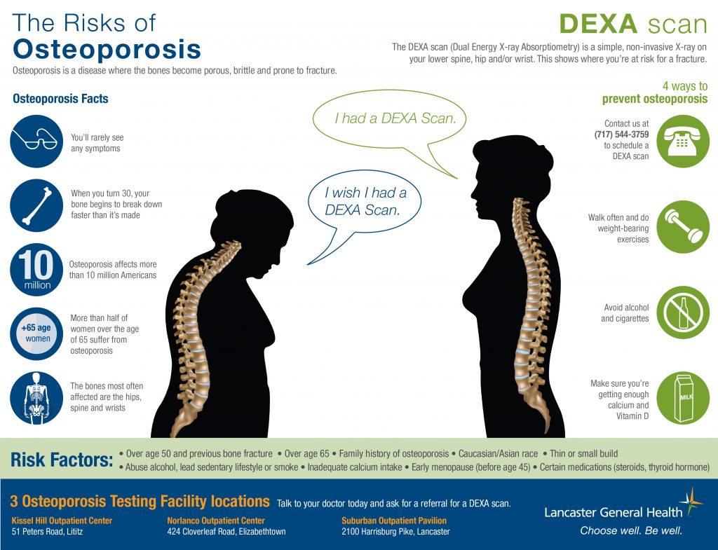 Fakta Tentang Osteoporosis
