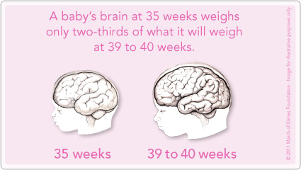 Risiko pada otak bayi yang lahir secara pramatang
