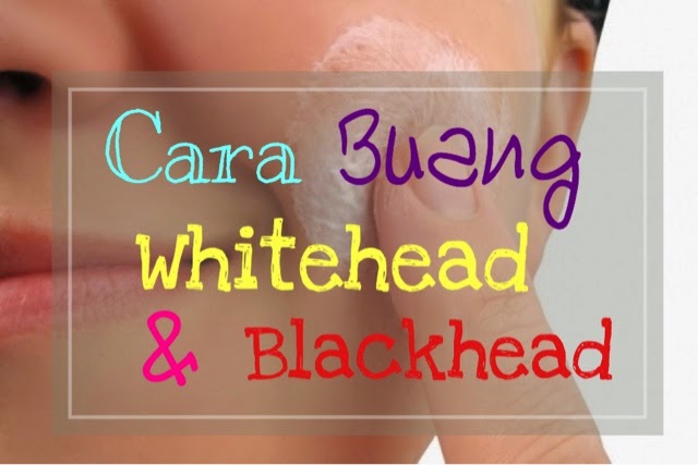 Cara Buang Blackhead dan Whitehead