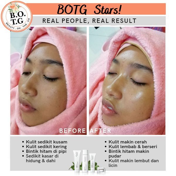 testimoni facial botg