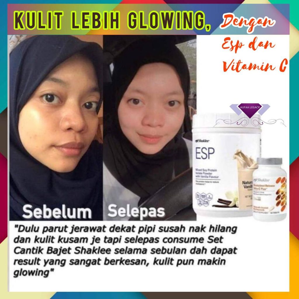 Parut jerawat hilang lepas amalkan vitamin kulit cantik shaklee
