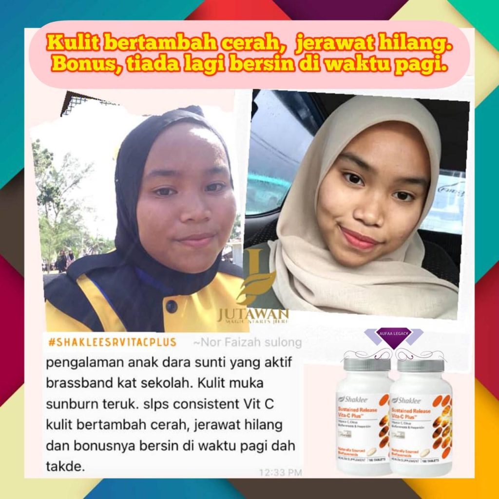 Remaja pun memilih vitamin kulit cantik shaklee