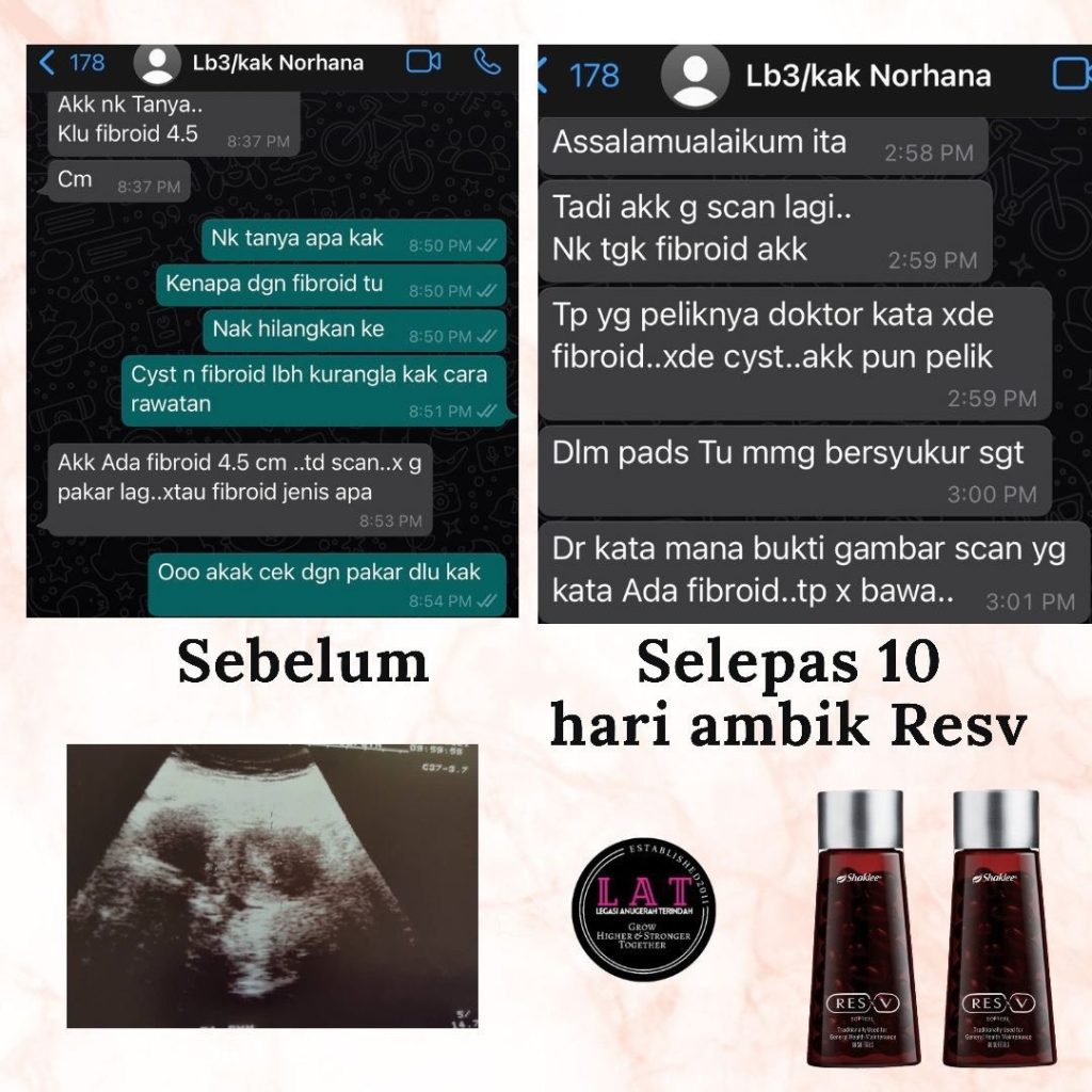 Testimoni cyst / fibroid ResV